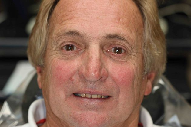 Smile Makeover Case 4 - Before