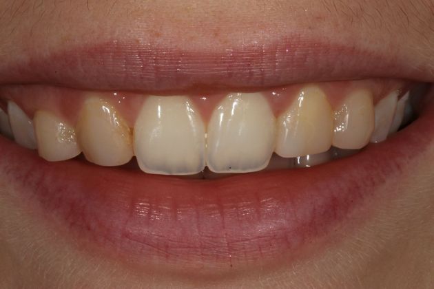Cosmetic Dentistry Case 3 - Before