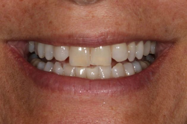 Cosmetic Dentistry Case 1 - Before