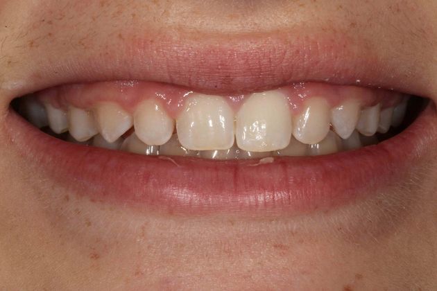 Cosmetic Dentistry Case 6 - Before