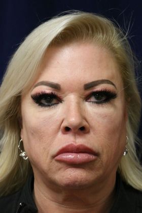 PDO Threads: Case 8 - Before