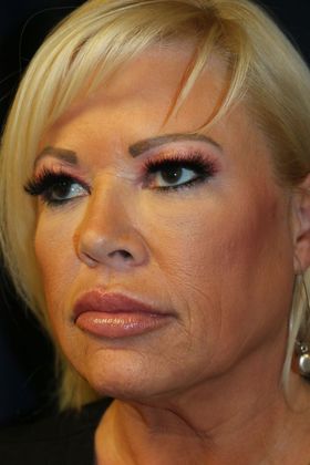 PDO Threads: Case 8 - Before