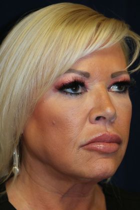 PDO Threads: Case 8 - After