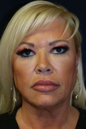 PDO Threads: Case 8 - After