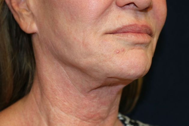 PDO Threads: Case 5 - Before