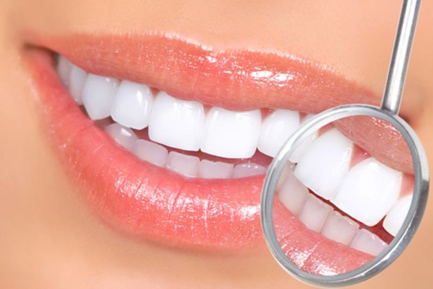 Dental Bonding - Teeth Bonding Cases