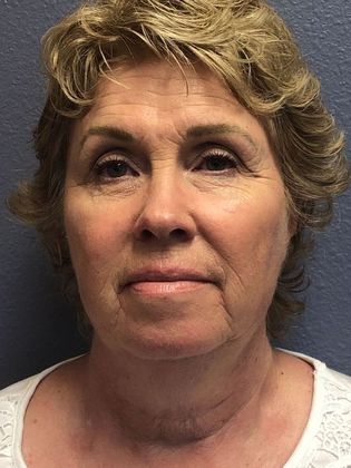 PDO Threads Case 7  - Before