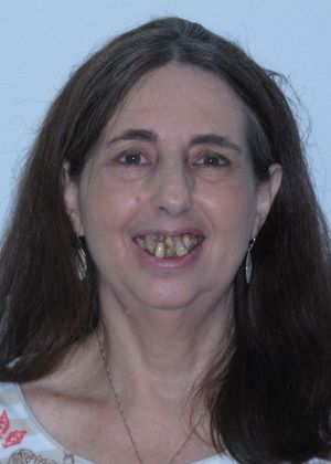 Prettau Zirconia Implant Bridge: Roslyn - Before