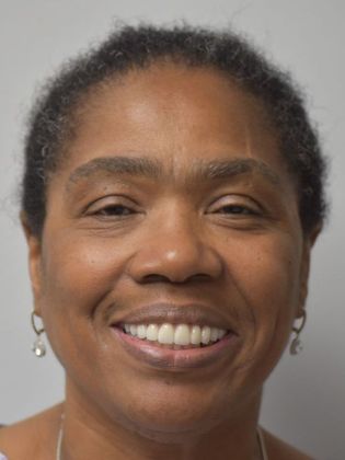 Prettau Zirconia Implant Bridge Cases