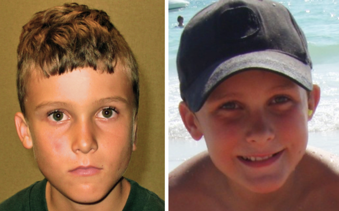Correcting Prior Surgeries: Patient 5 - 9 year old with 4 prior cartilage surgeries, after single Medpor revision.