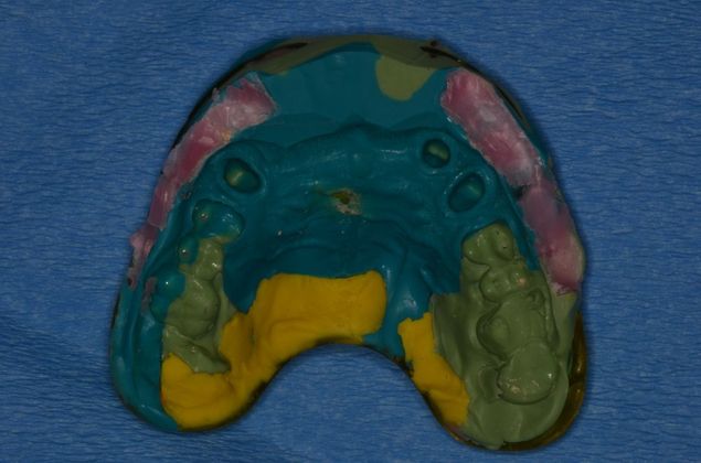 Bridges: Case 4 - Before