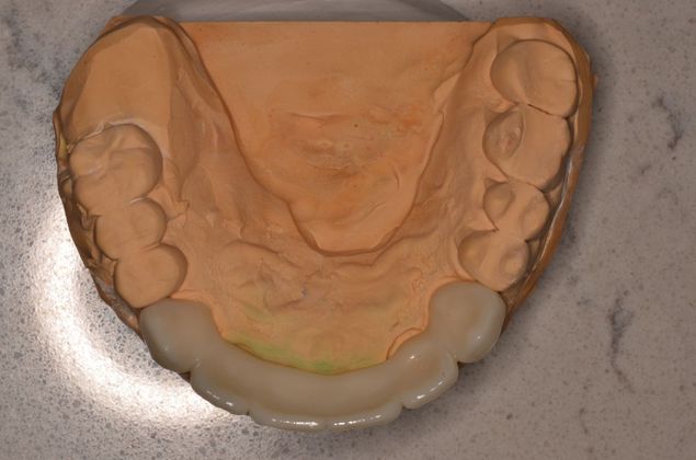 Bridges: Case 4 - After