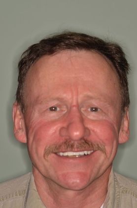 Bridges: Case 4 - After