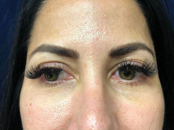 PDO Threads Case 4  - Before