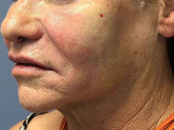 PDO Threads: Case 3 - After