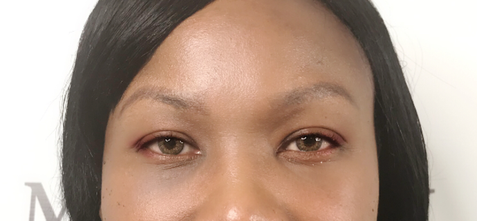 Cosmetic Tattooing: Permanent Makeup Brows - Before