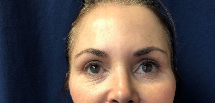 Cosmetic Tattooing: Brow Powder Shading Reno - Before