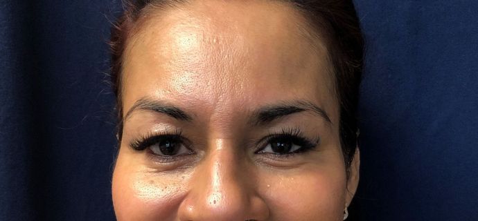 Cosmetic Tattooing: Cosmetic Brow Tattooing - Before
