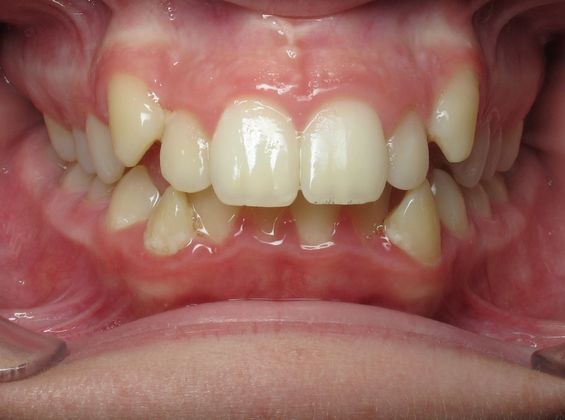 Dominic Dominic - Before