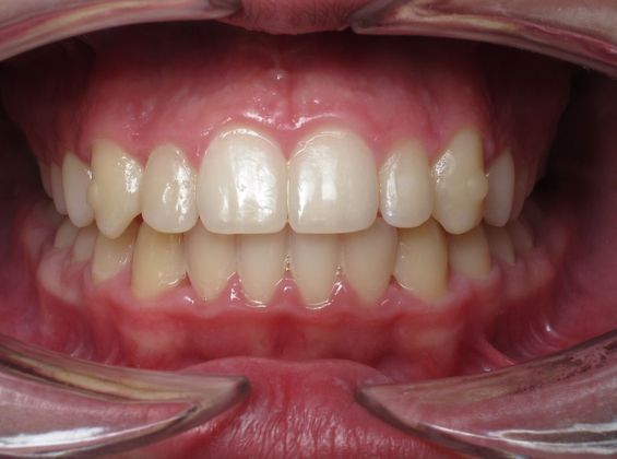 Dominic Dominic - After