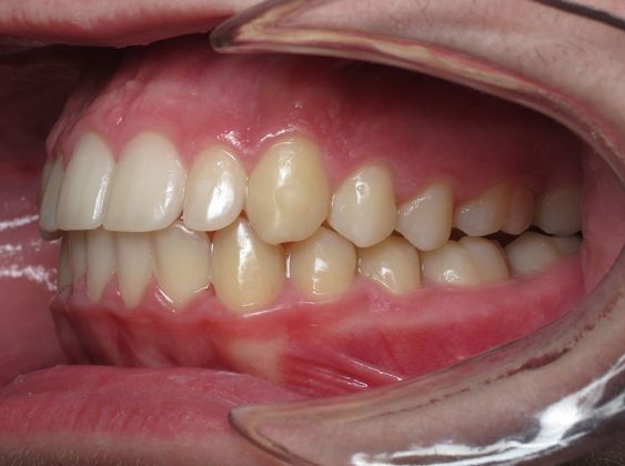 Dominic: Dominic - Before