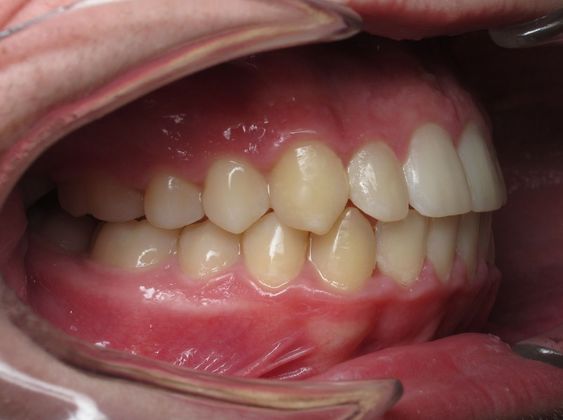 Dominic: Dominic - After