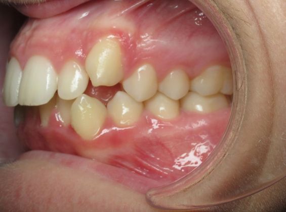 Dominic: Dominic - After