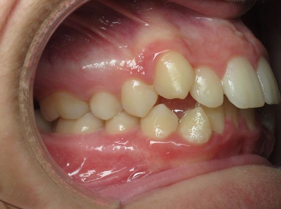 Dominic: Dominic - Before