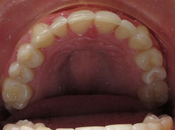 Alana: Alana - After