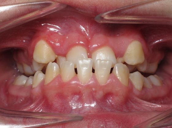 Alana Alana - Before