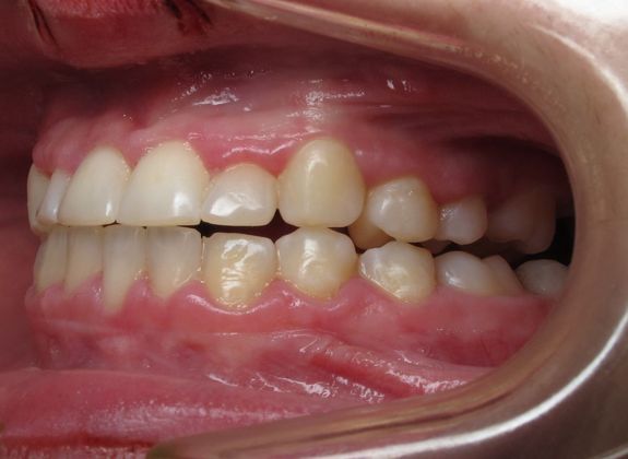 Alana: Alana - After