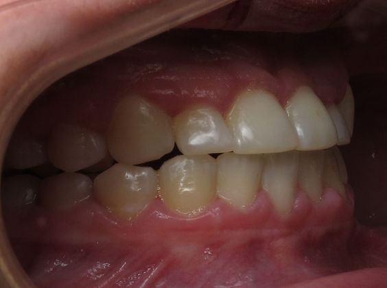 Alana: Alana - After