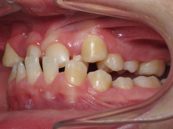 Alana: Alana - Before