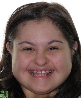 Alana: Alana - After