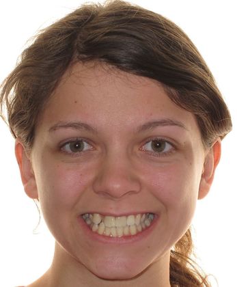 Louise: Louise - Before