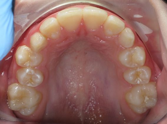 Hailey: Case 1 - Before