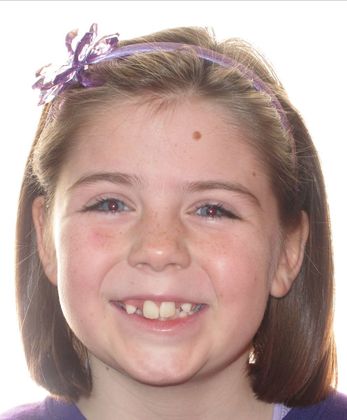 Hailey Case 1 - Before