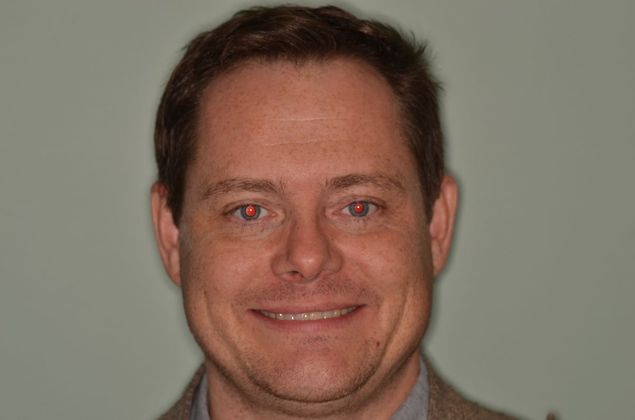 Porcelain Veneers: Case 21 - Before Porcelain veneers