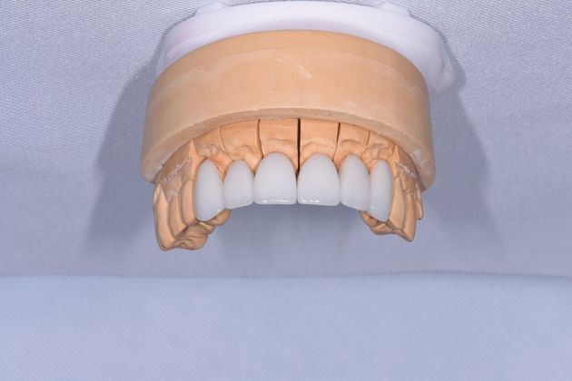 Cosmetic Dentistry: Case 1 - Richwood - Before