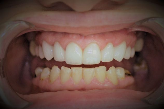 Cosmetic Dentistry: Case 2 - Bay City - After