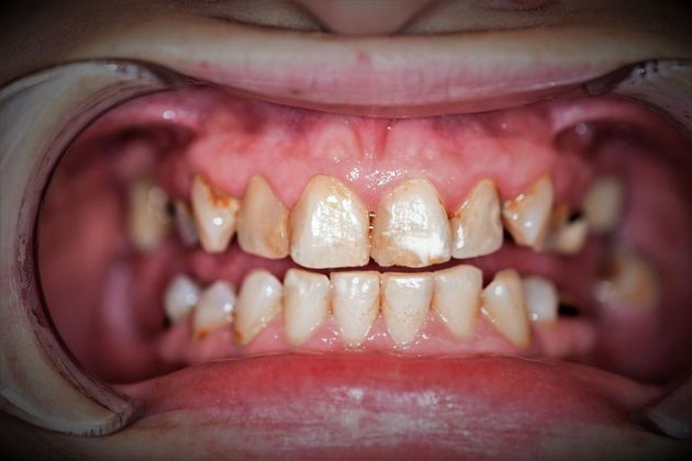 Cosmetic Dentistry: Case 2 - Bay City - Before