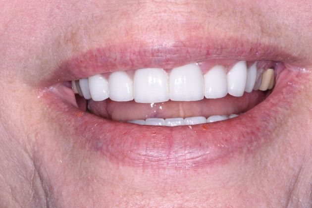 Cosmetic Dentistry Case 3 - Jones Creek - After
