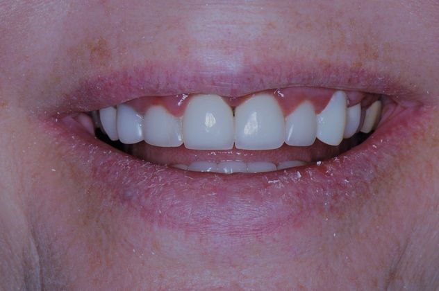 Cosmetic Dentistry: Case 3 - Jones Creek - Before