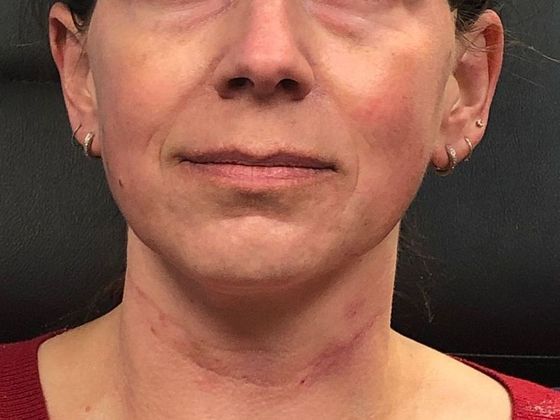 PDO Threads Case 2 - After