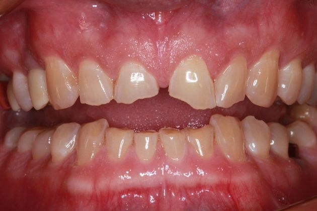 Full Mouth Makeovers: Case 2 - After