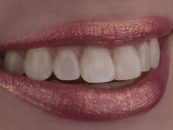 Orthodontics: Case 2 - After