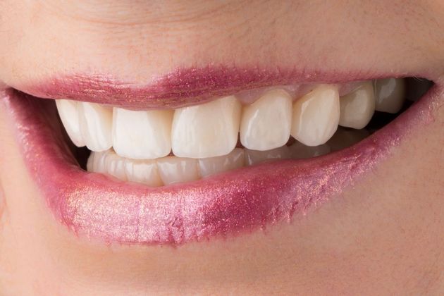 Dental Crowns: Case 2 - After