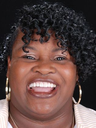 Full Mouth Makeovers Case 5 - After