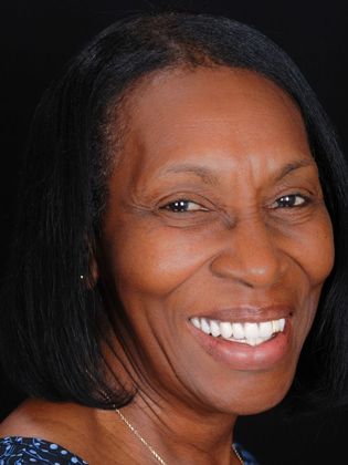 Dentures: Case 1 - After