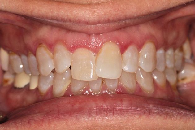 Full Mouth Makeovers: Case 8 - Before